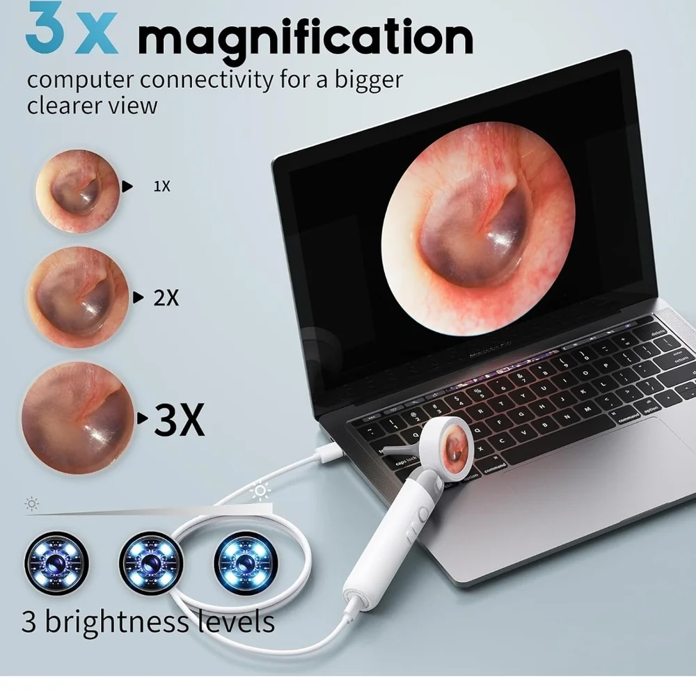 Digital Ear Camera with 3x Magnification